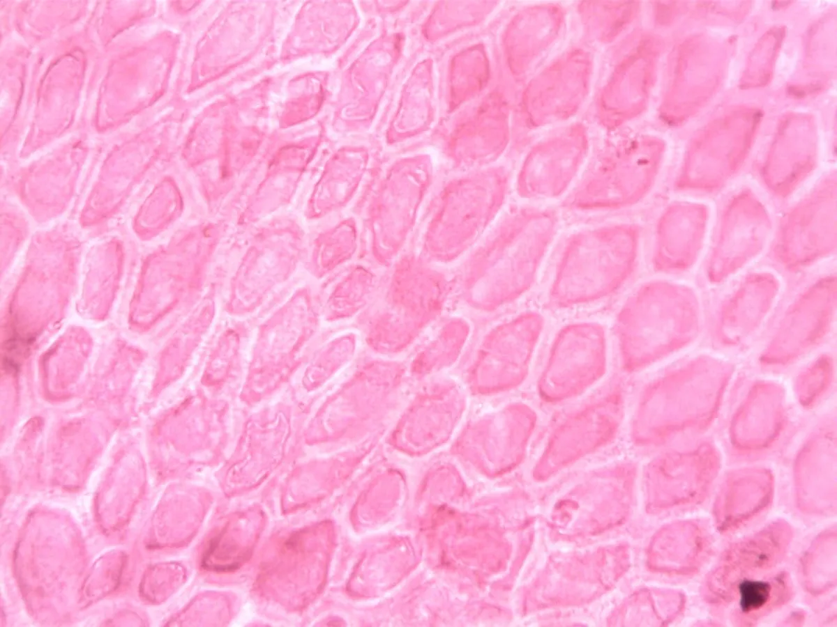 Tissue healing and regeneration stimulated by shockwave therapy
