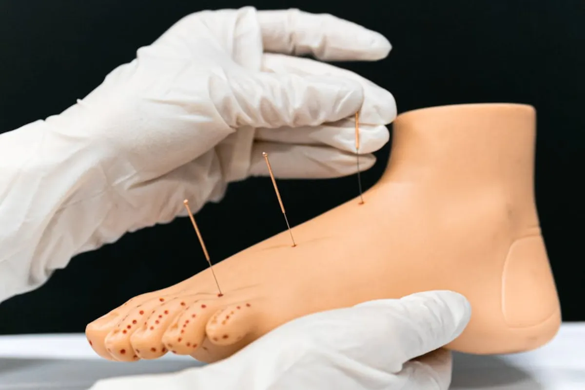 Shockwave therapy applied to heel for plantar fasciitis treatment